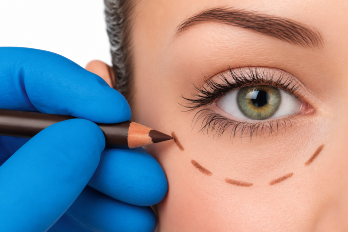 oculoplastica green eye small